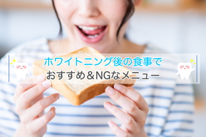 具体例あり！ホワイトニング後の食事でおすすめ＆NGなメニュー