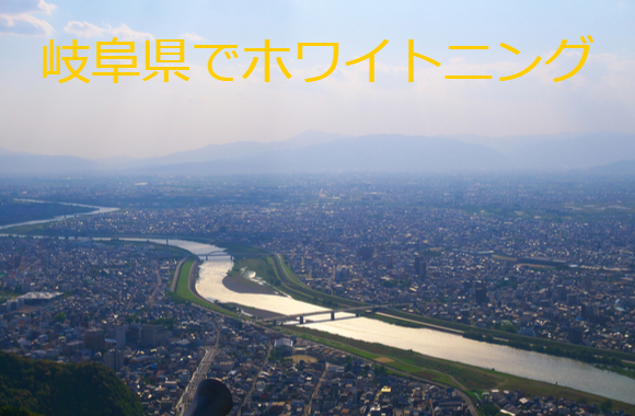 岐阜県でホワイトニングにおすすめの歯科クリニック6選