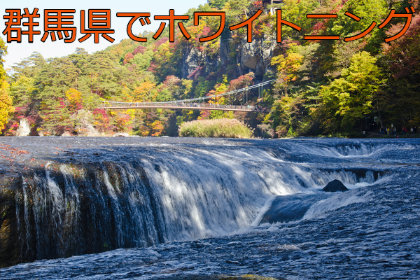 群馬県でホワイトニングにおすすめの歯科クリニック6選！口コミと料金も掲載