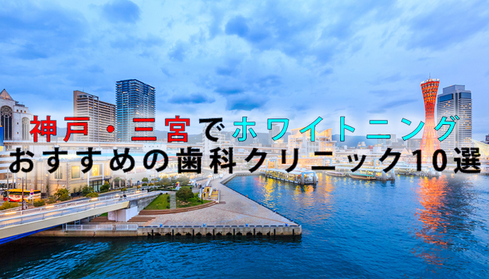 神戸・三宮でホワイトニングにおすすめの歯科クリニック10選【2024年版】