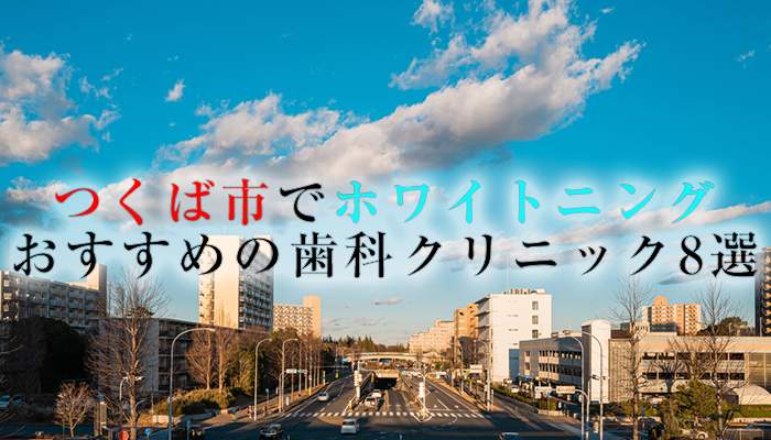 つくば市でホワイトニングにおすすめの歯科クリニック11選【2024年版】