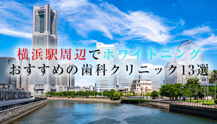 横浜でホワイトニングにおすすめの歯科クリニック14選！口コミと料金も掲載【2024年版】